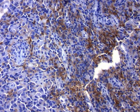 CD274 / B7-H1 / PD-L1 Antibody (C-Terminus, clone OR-5H8)