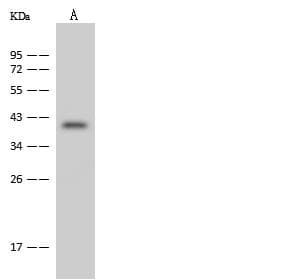 FBXO28 Antibody