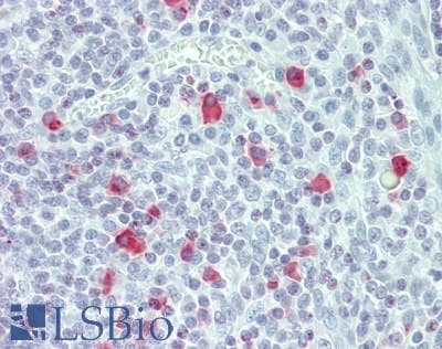 IHC-plus™ Polyclonal Rabbit anti-Human ACSS2 / ACAS2 Antibody (aa261-290, IHC, WB)
