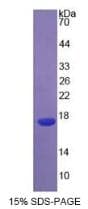 Human IL4 Protein (Recombinant His, N-Terminal)