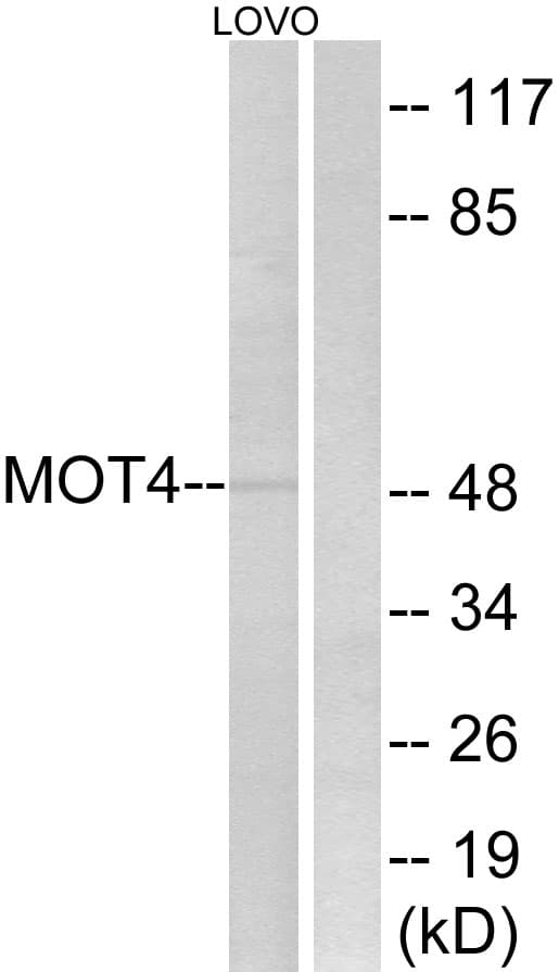 Polyclonal Rabbit anti-Human SLC16A3 Antibody (aa233-282, WB)