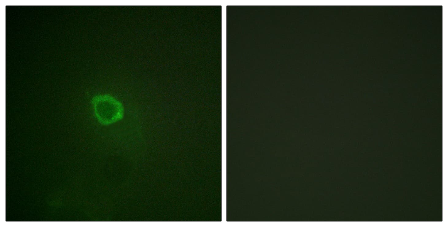 IL13RA1 / IL13R Alpha 1 Antibody (phospho-Tyr405)