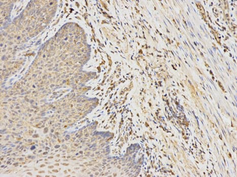 ANGPTL4 Antibody