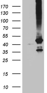 GNA14 Antibody (aa31-348, clone OTI4A4)