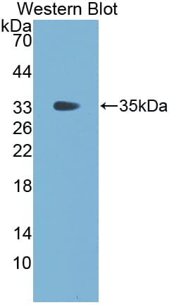 FGG / Fibrinogen Gamma Antibody (aa168-444, Biotin)