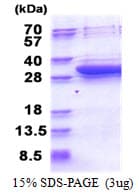 Human ECI1 / DCI Protein (Recombinant His)