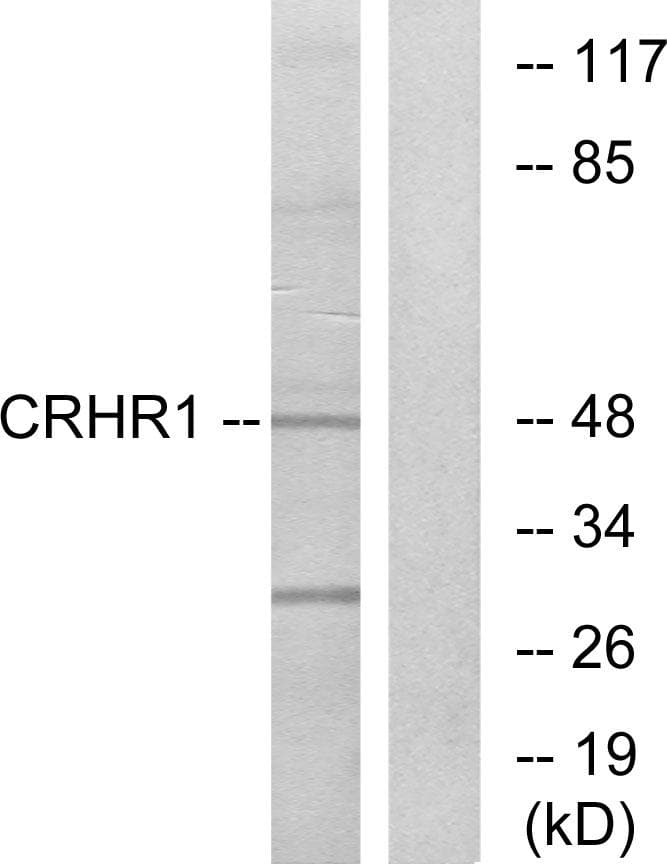 CRFR1 / CRHR1 Antibody
