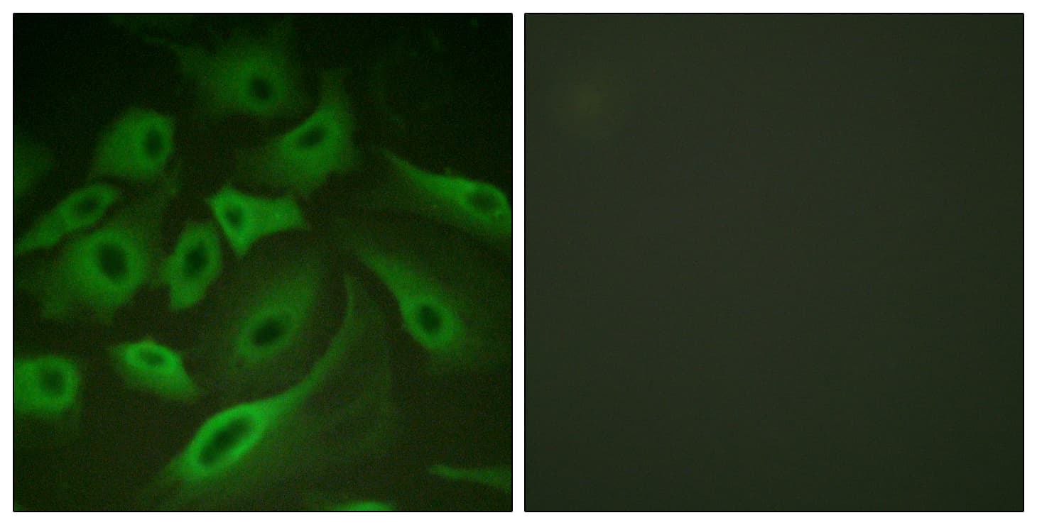 Polyclonal Rabbit anti-Human PLN / Phospholamban Antibody (aa1-50, IF)