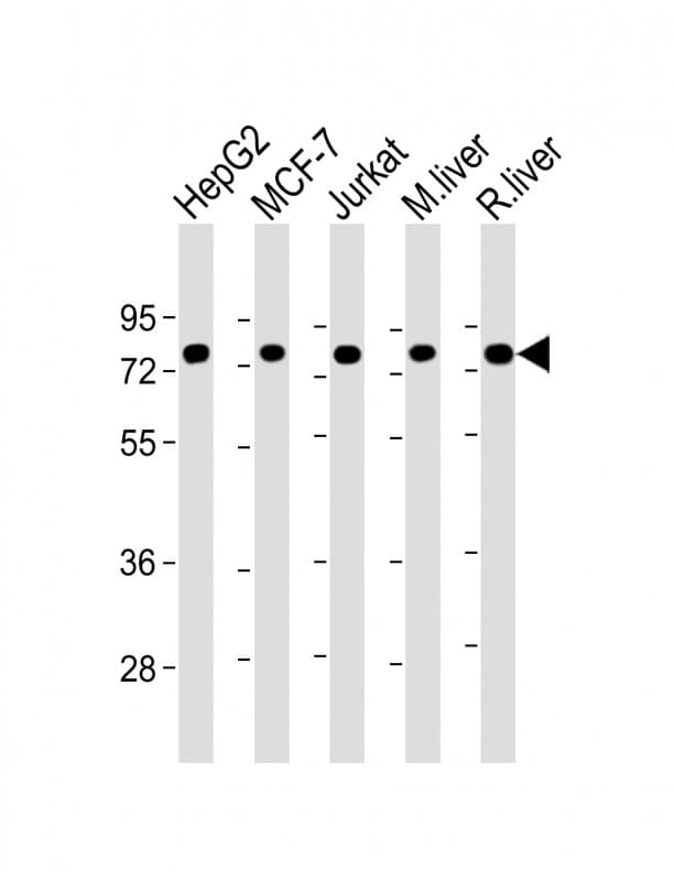 IHC-plus™ HSPA5 / GRP78 / BiP Antibody (clone 1672CT323.22.82)
