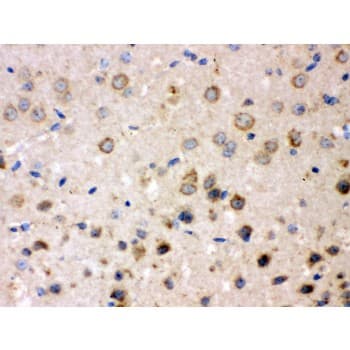 APBB1 / FE65 Antibody (aa21-56)