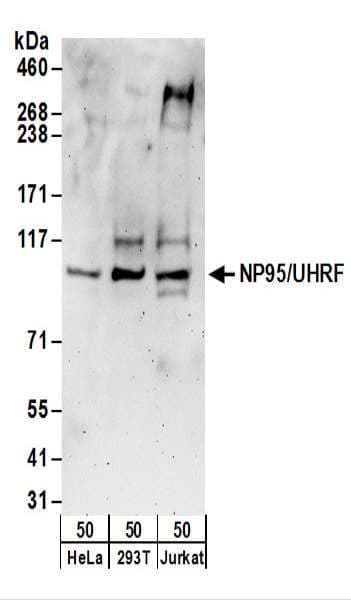 UHRF1 Antibody (aa275-325)