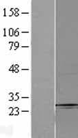 FBXO32 / Fbx32 Protein (Over-Expression Lysate Myc-DDK (Flag))