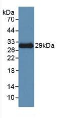 ACTC1 / Alpha Cardiac Actin Antibody