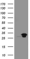 UBE2S / E2 EPF Antibody (clone OTI1B5)