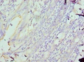 MAD2L1 / MAD2 Antibody (aa1-205)