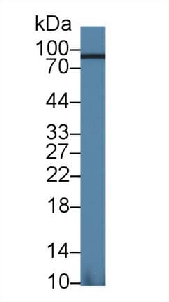 ACO1 / Aconitase Antibody (aa527-719, APC)