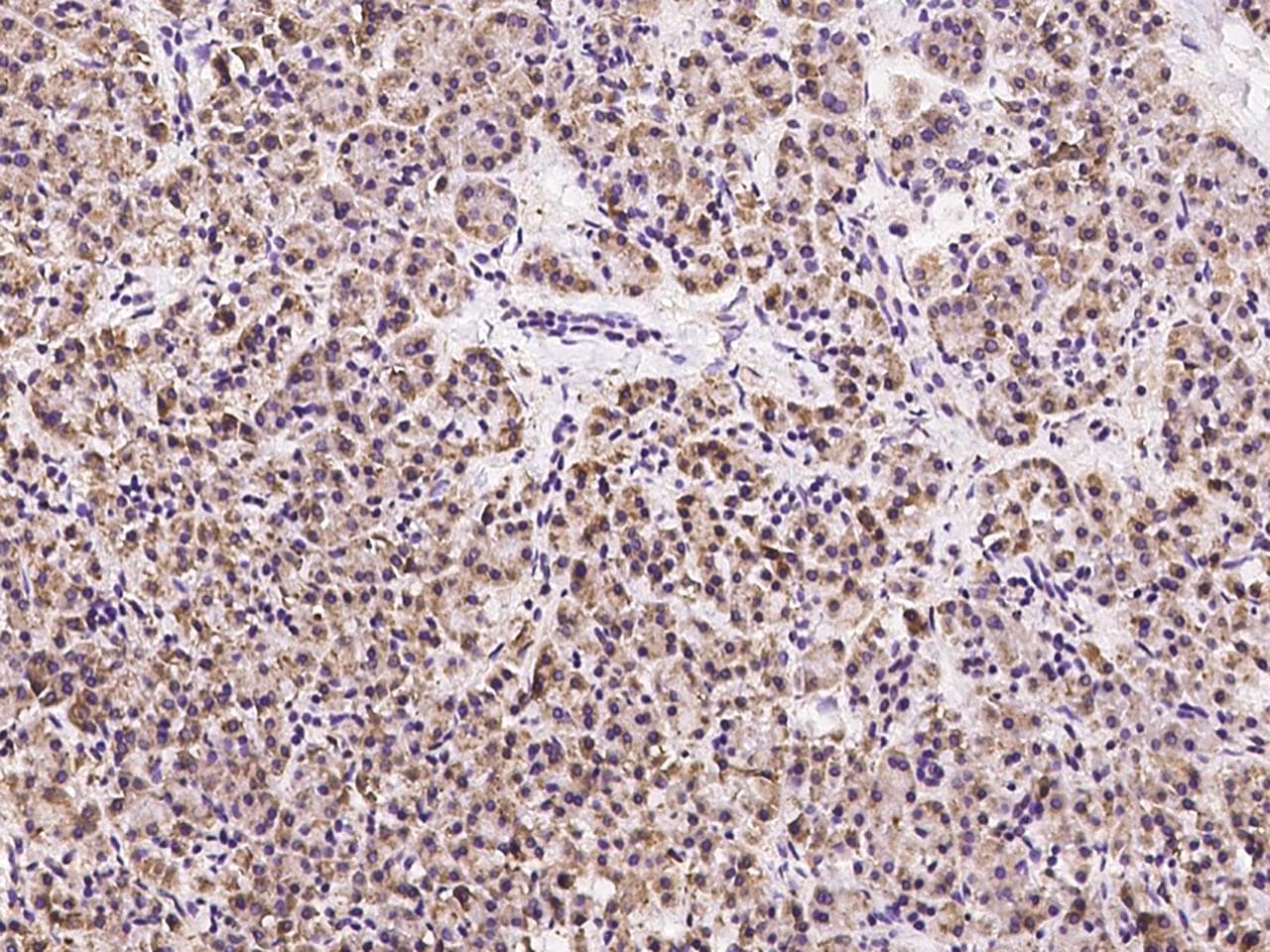 GLIPR1 / GLIPR Antibody