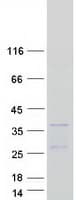 Human HOXB7 Protein (Recombinant Myc-DDK (Flag))