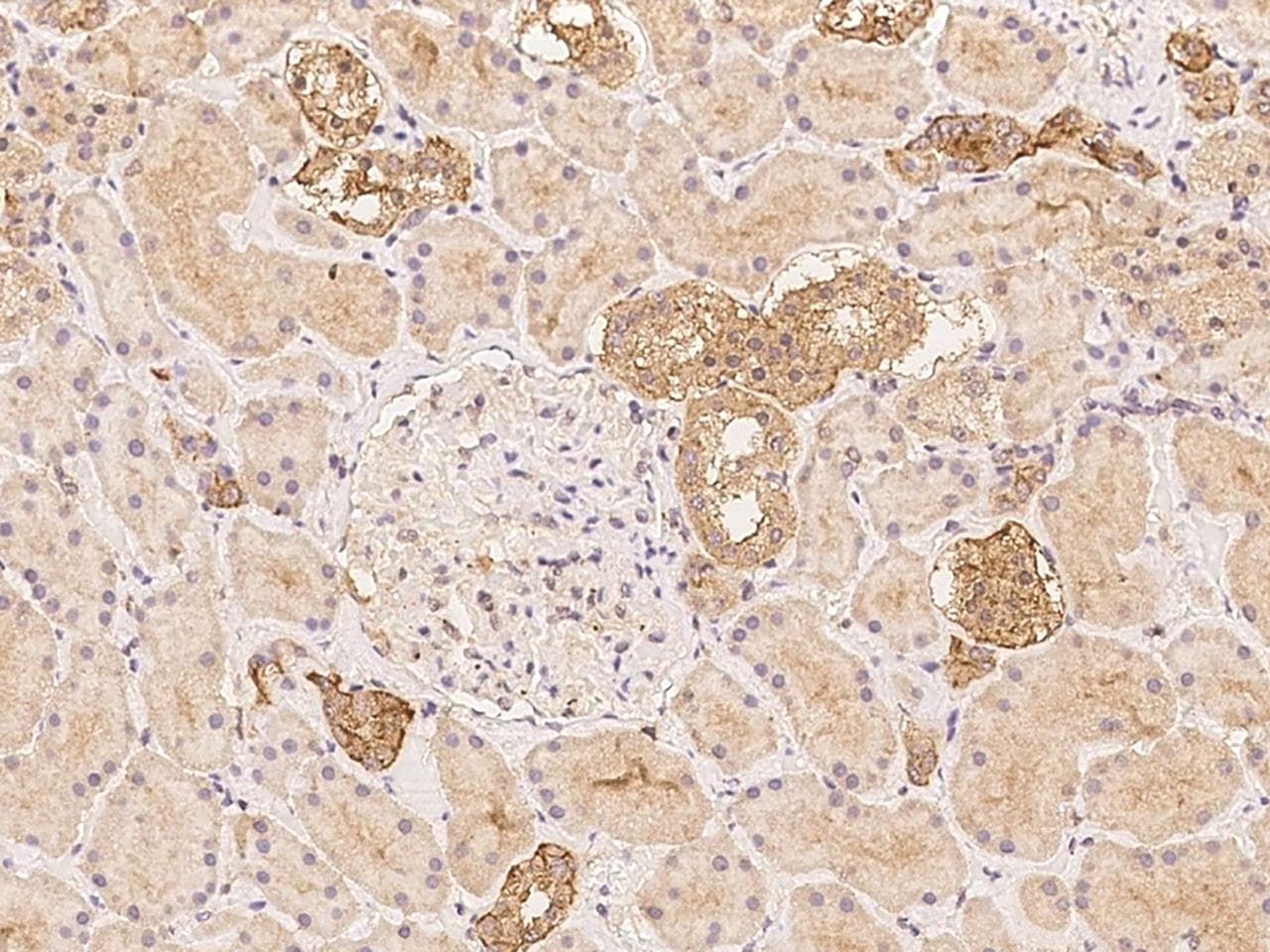 CP / Ceruloplasmin Antibody