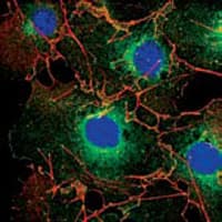 IHC-plus™ lpp Antibody (clone 8B3A11)