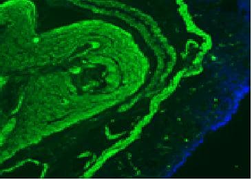 PathPlus™ DES / Desmin Antibody (clone D9)