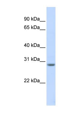 Polyclonal Rabbit anti-Human MARCH8 Antibody (aa216-265, WB)