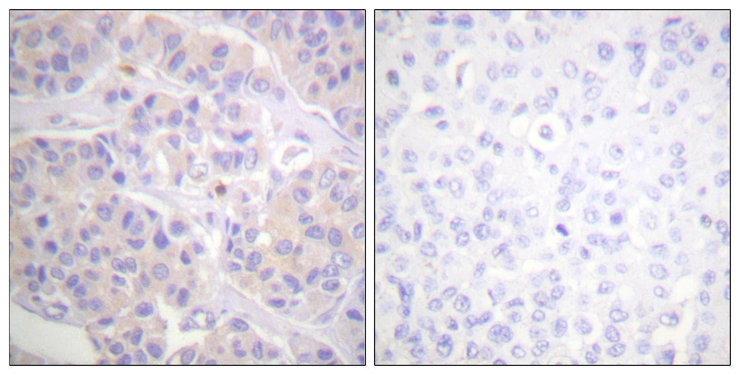 Polyclonal Rabbit anti-Human BCAR1 / p130Cas Antibody (IHC)