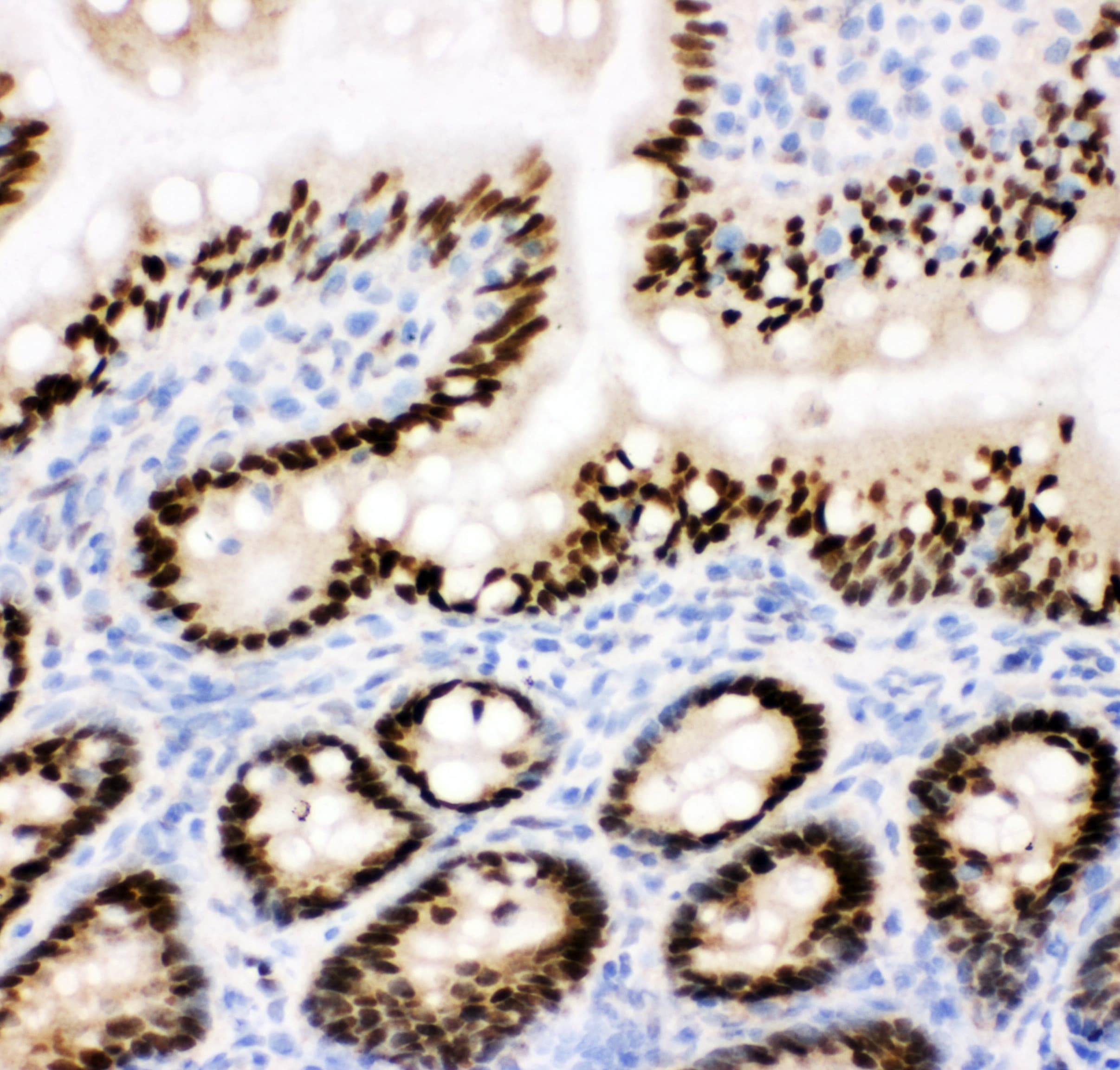 Polyclonal Rabbit anti-Human CTBP2 Antibody (aa429-445, IHC, WB)