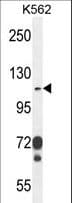 ITGAE / CD103 Antibody (aa1146-1173)