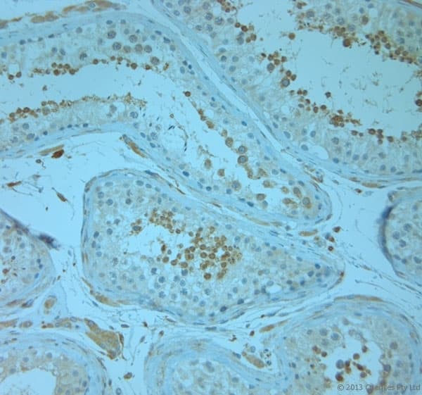 Polyclonal Rabbit anti-Human REEP5 Antibody (aa150-189, IHC)