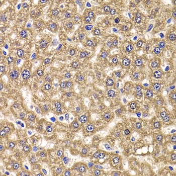 UBC6 / UBE2J2 Antibody