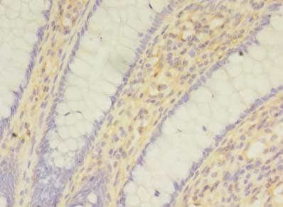 SNAI1 / SNAIL-1 Antibody
