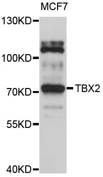 TBX2 Antibody