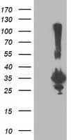 Monoclonal Mouse anti-Human PNMT Antibody (clone OTI1F1, IF, WB)