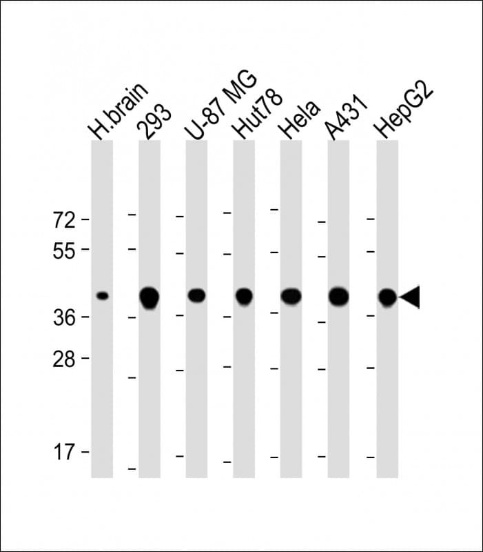 TOMM40 / TOM40 Antibody (N-Terminus)