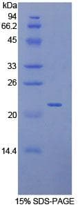 Human TLR7 / CD287 Protein (Recombinant 6His, N-terminus)