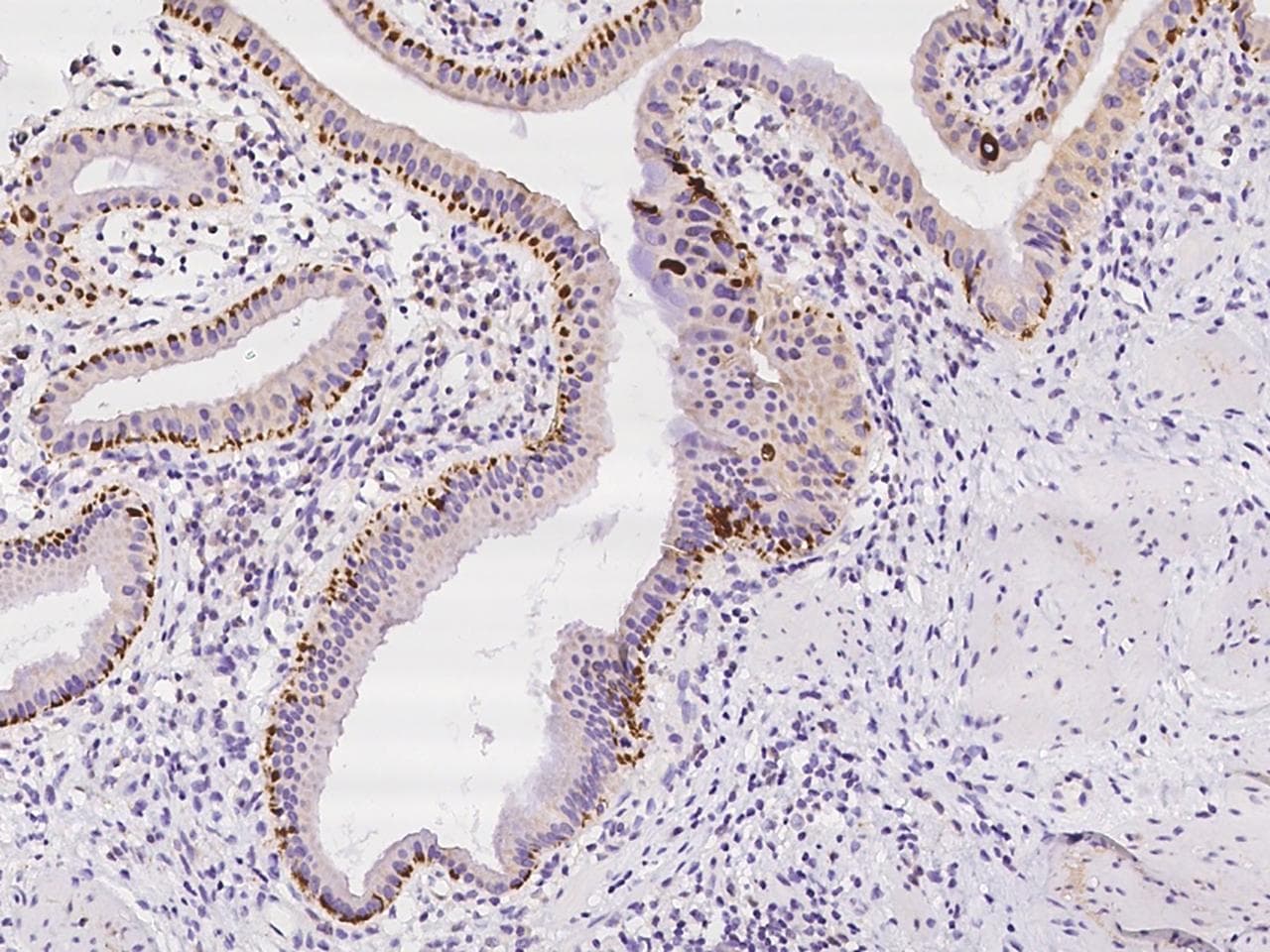 GRB14 Antibody