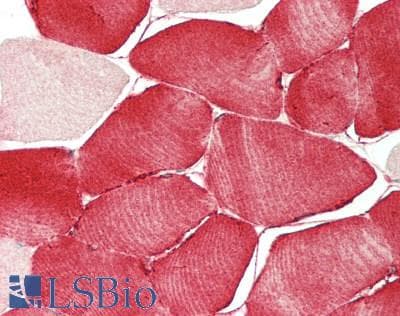 IHC-plus™ TSTA3 / GDP-L-Fucose Synthase Antibody (aa205-254)