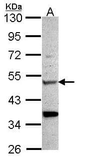 CHIT1 / Chitotriosidase Antibody (aa216-463)