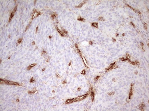 PROCR / EPCR Antibody (aa1-210, clone UMAB200)