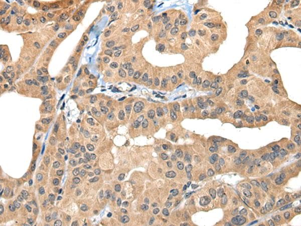 BHMT2 Antibody