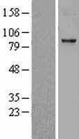CPT1C Protein (Over-Expression Lysate Myc-DDK (Flag))