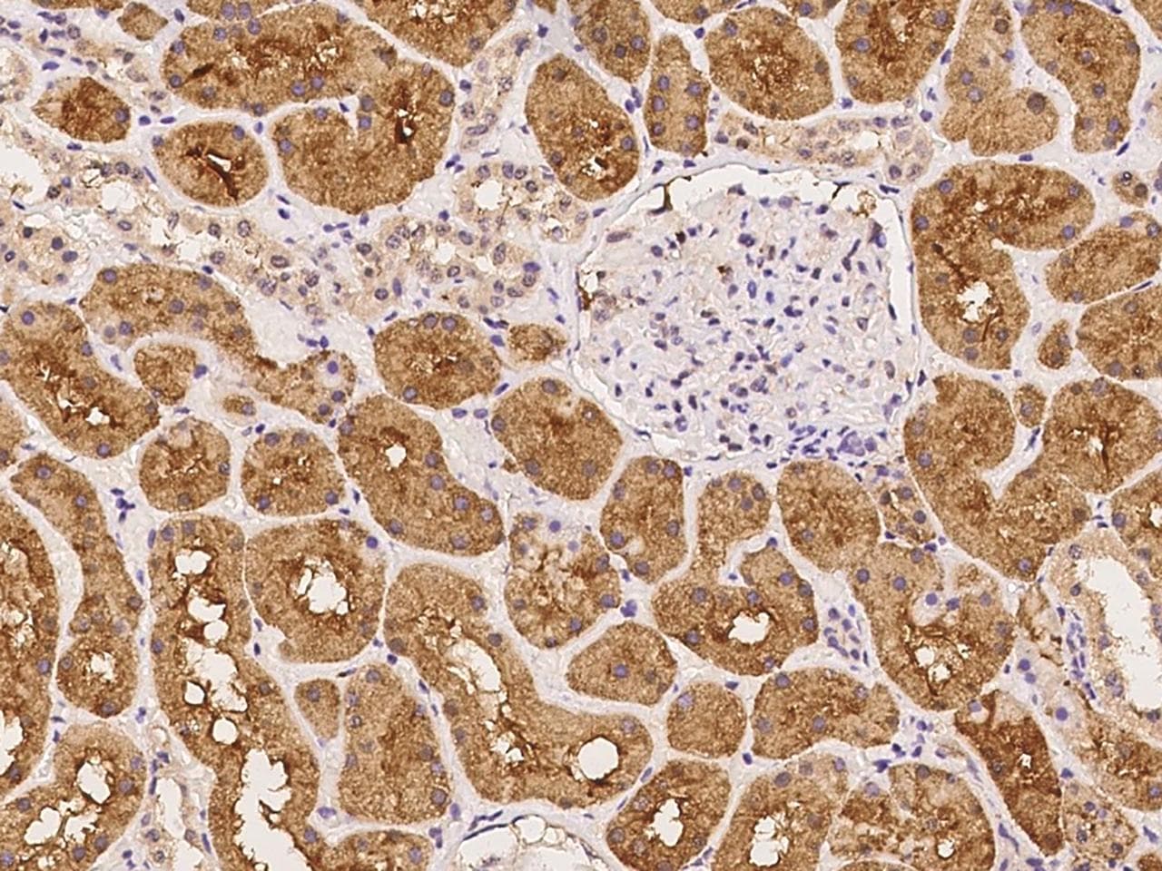 ARHGAP21 Antibody
