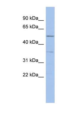 ABHD15 Antibody (aa179-228)