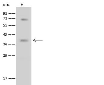 NIX / BNIP3L Antibody (Preservative Free)