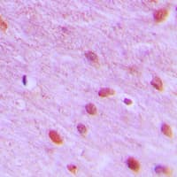 Polyclonal Rabbit anti-Human RFC3 Antibody (Internal, IHC, WB)