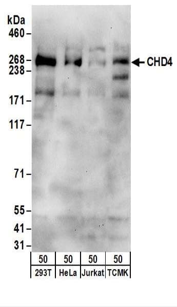 CHD4 Antibody (aa25-75)