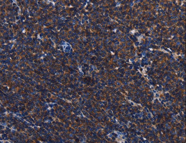 Polyclonal Rabbit anti-Human CD45 / LCA Antibody (IHC)