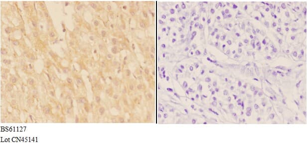 Polyclonal Rabbit anti-Human ADAMTS7 Antibody (IHC, WB)
