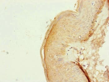 NDUFB10 Antibody